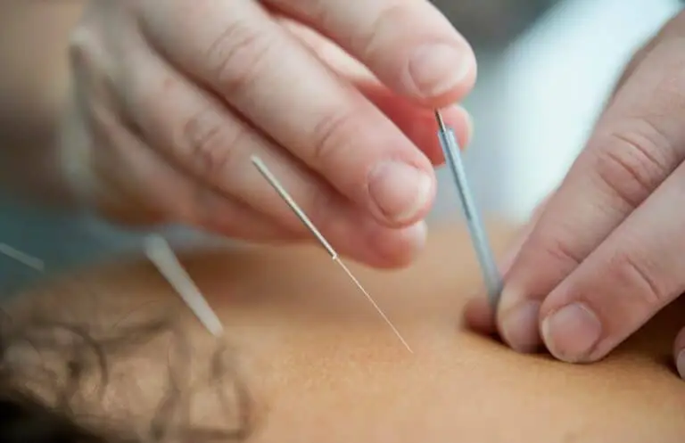 Can Acupuncture Help You Avoid Surgery? Here’s What the Science Says