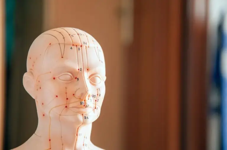 How Often Should You Do Acupuncture