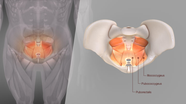 Levator Ani Syndrome: Understanding Pelvic Floor Dysfunction and Anal Pain