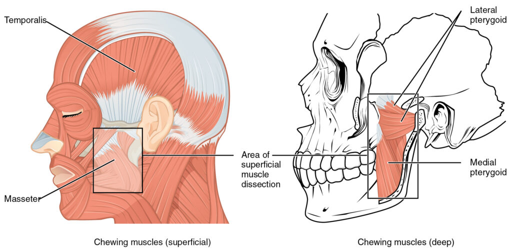 Medial Pterygoid Trigger Points: Referral Patterns, Assessment, and Safe Relief Medial pterygoid