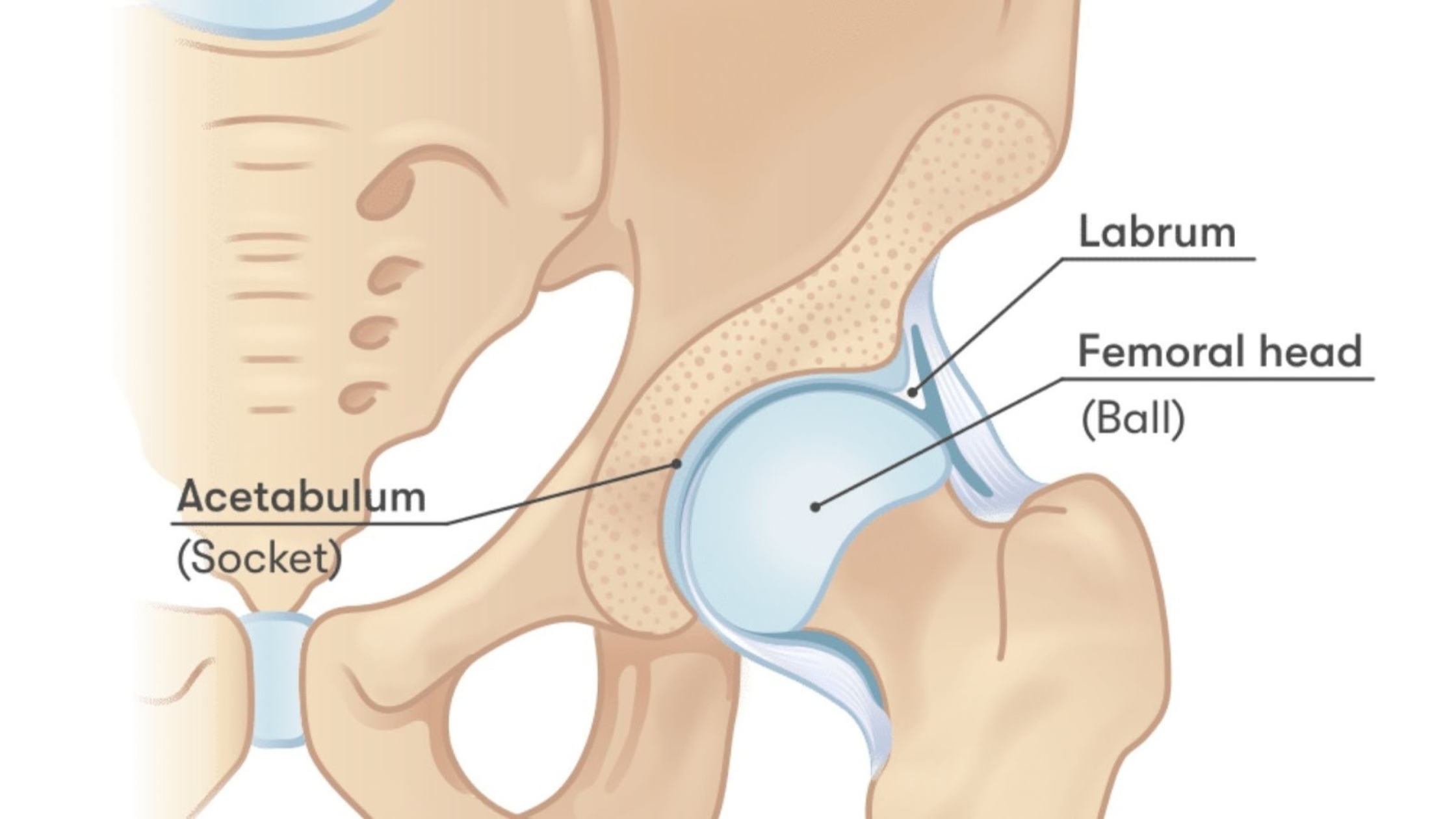 Acupuncture for Hip Pain from Arthritis, Sciatica, and Tight Muscles