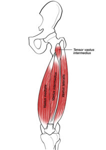 Understanding Vastus Intermedius Trigger Points in New York, NY vastus intermedius