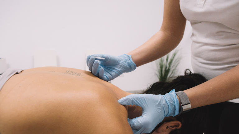 Dry Needling Clinic Upper West Side