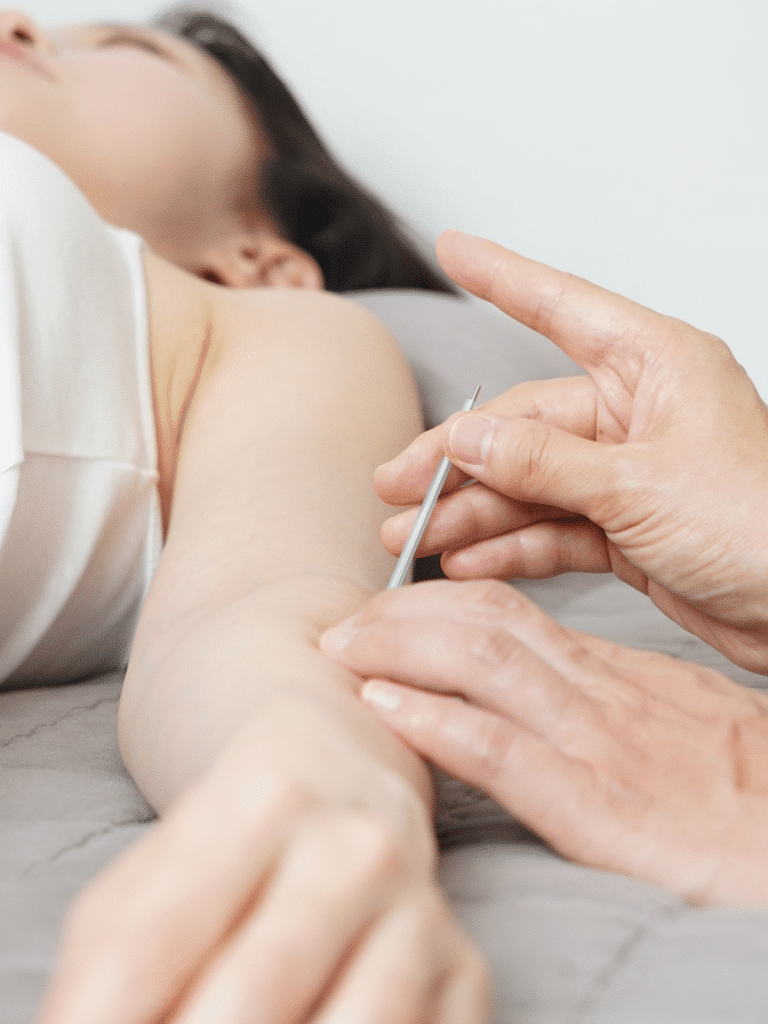 Dry Needling Upper West Side NYC
