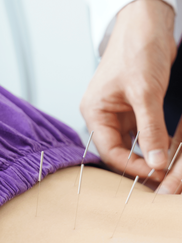 Pelvic Floor Acupuncture NYC