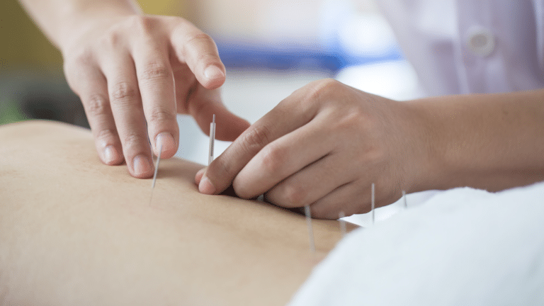 Looking for Pelvic Floor Acupuncture in Midtown? Start Here