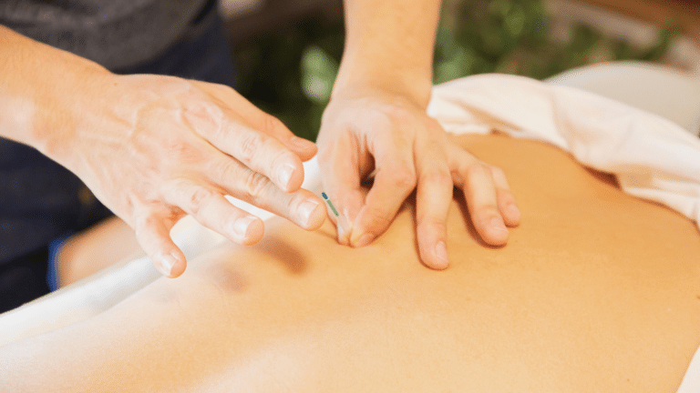 ED Treatment with Neuromodulation Acupuncture on the Upper West Side