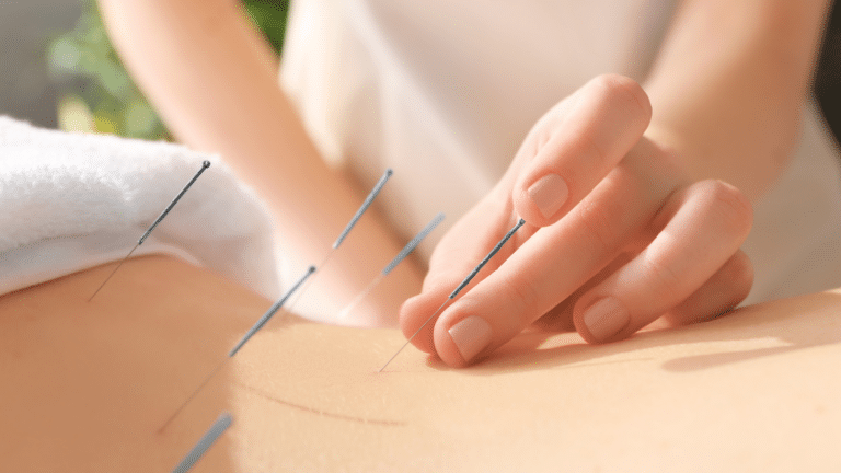 Pelvic Floor Dry Needling and Acupuncture for Pain in NYC